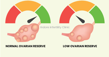 Infertility Image