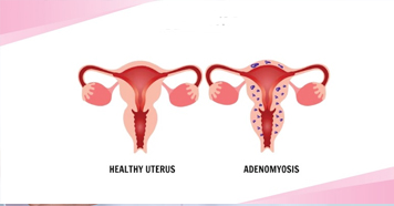 Ayurvedic Image