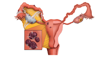 Ayurvedic Image