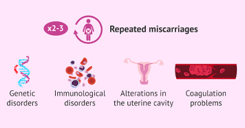 Infertility Image