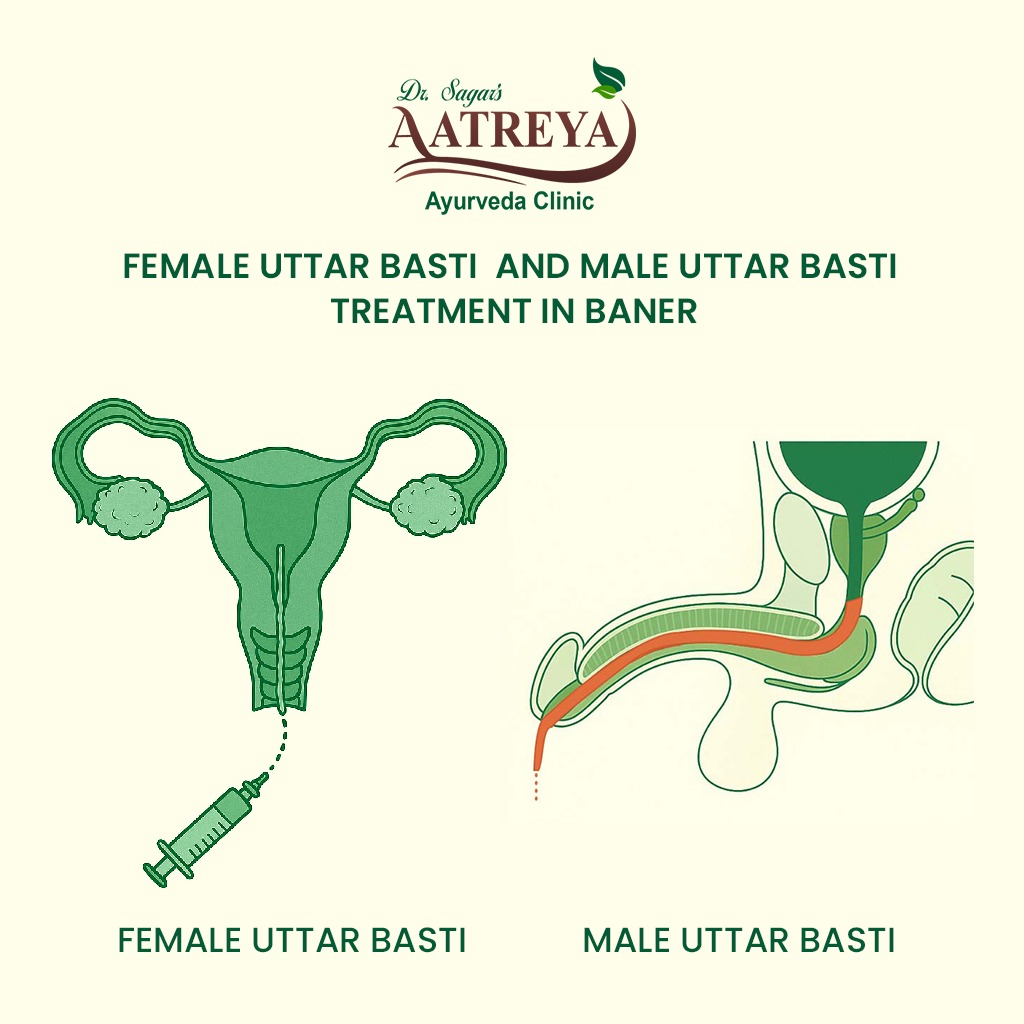 Uttar Basti Treatment in Baner | Aatreya Ayurveda & Panchakarma Clinic