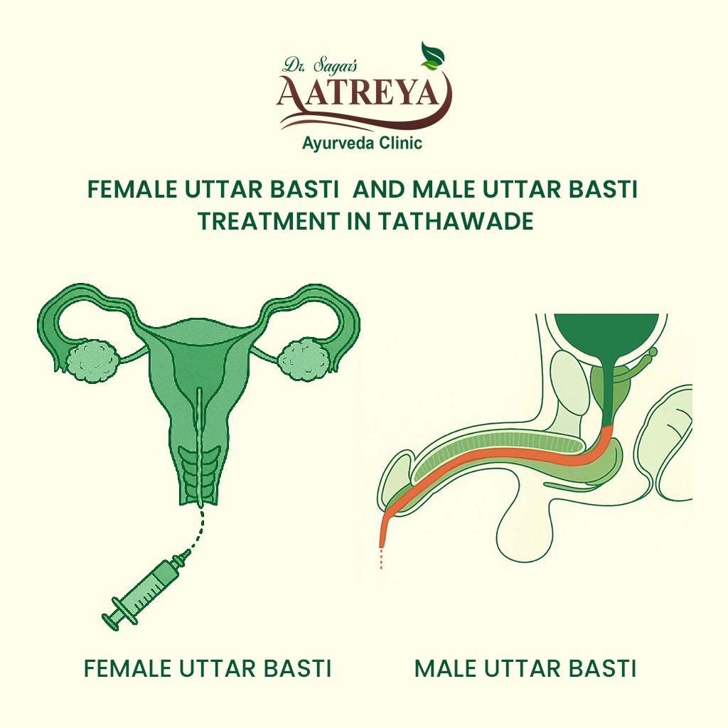 Uttar Basti Treatment in Tathawade | Aatreya Ayurveda & Panchakarma Clinic