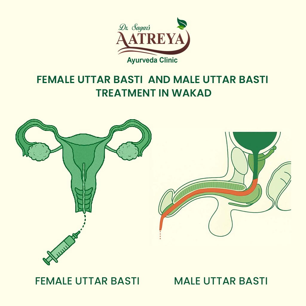 Uttar Basti Treatment in Wakad | Aatreya Ayurveda & Panchakarma Clinic